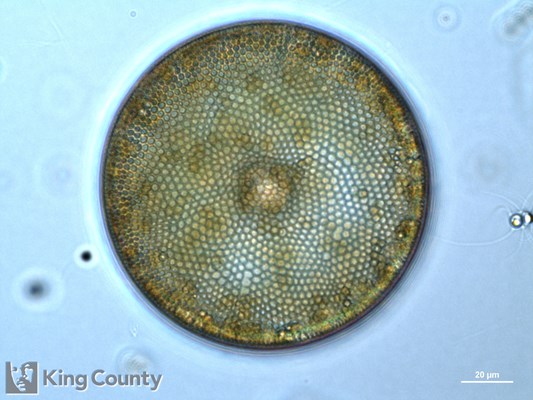 Photo of Coscinodiscus spp.